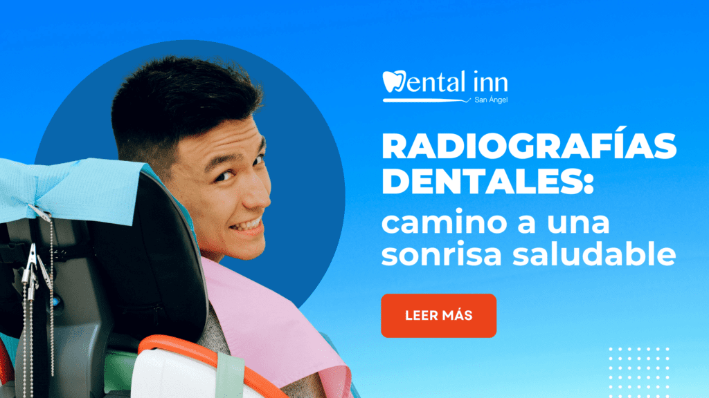 radiografías dentales