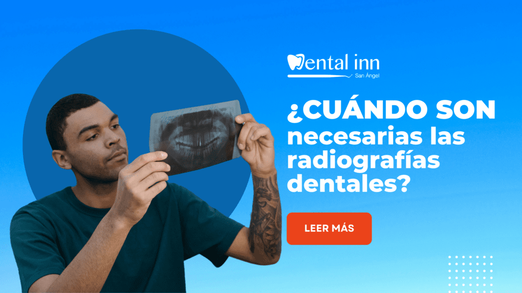 radiografía dental