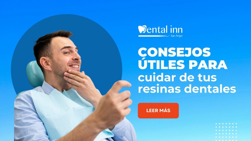 resinas dentales